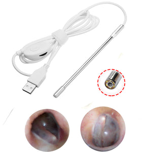 4.9mm Lens Medical USB Ear Nose Endoscope Borescope Inspection Otoscope Endoscope Camera