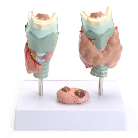 Human Anatomical Thyroid Gland Pathology Anatomy Medical Teaching Model