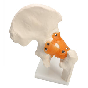 NEW Life Size Anatomical Functional Human Hip Joint Anatomy Model