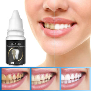 10 ml Teeth Whitening Cream Remove Black Tooth Yellow Tooth Tooth Tea Stains Teeth Care